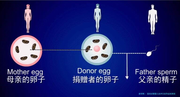 医院试管婴儿技术引发争议的原因