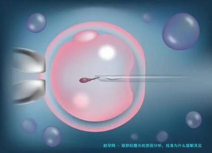 取卵后腹水的原因分析，找准为什么缓解其实并不难
