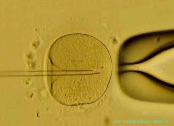 江西试管婴儿生孩孩成功   费用多少，附试管医院排名