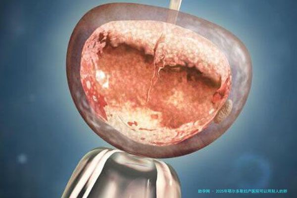 2025年鄂尔多斯妇产医院可以用别人的卵泡做试管婴儿吗？费用多少