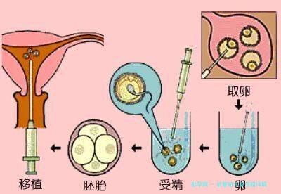 试管短方案流程详解