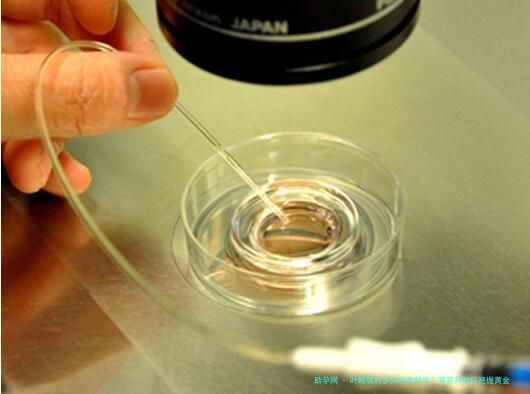 叶酸饭后多久吃最科学？营养师教你把握黄金补充时间