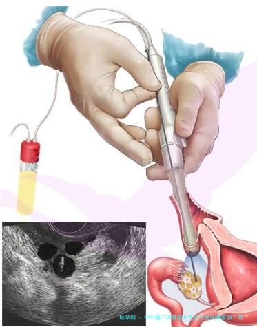 2025厦门试管婴儿生孩子医院哪家强？附3家医院热门推荐
