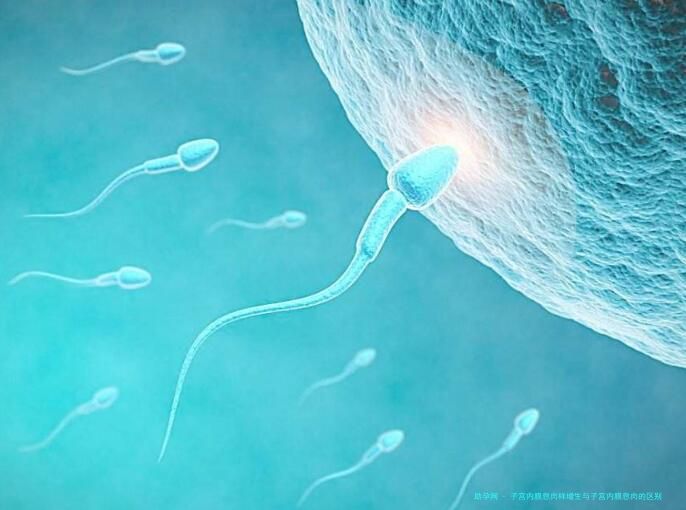 子宫内膜息肉样增生与子宫内膜息肉的区别 如何准确分辨