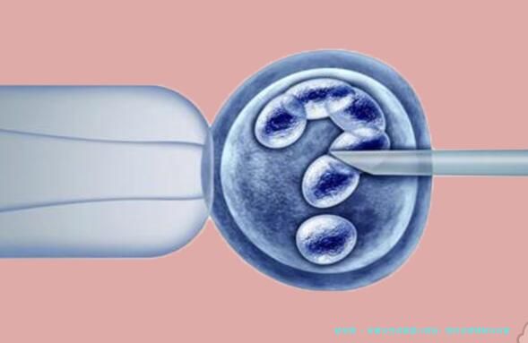 未婚女性试管婴儿现状：国内法律限制与石家庄医院费用解析
