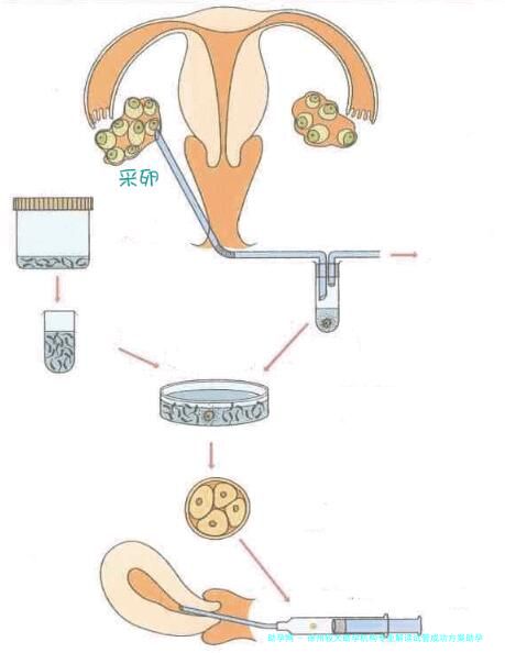 徐州较大助孕机构专业解读试管成功方案助孕机构常见问题解答