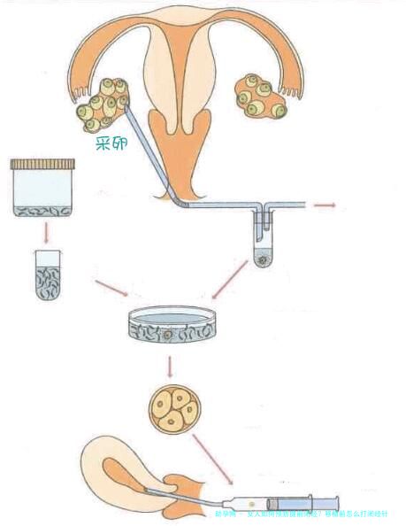 女人如何预防提前闭经？移植前怎么打闭经针有效果？