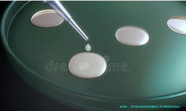 苏州做试管的医院哪家好(苏州哪家医院做试管成功率高)