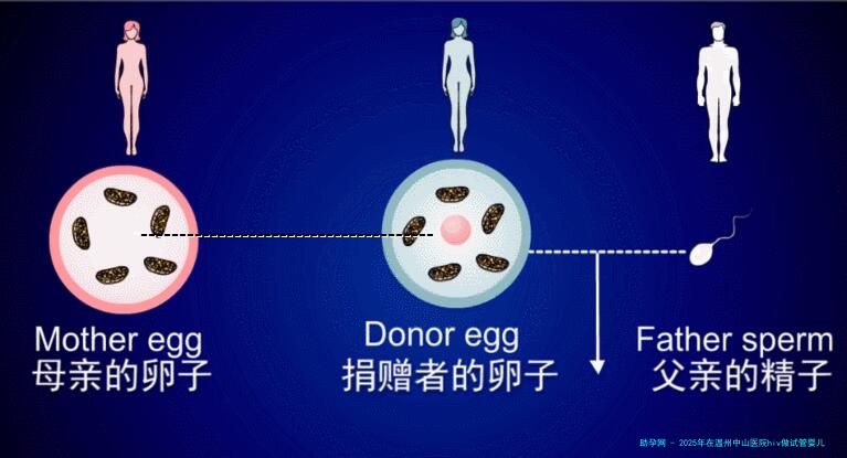 2025年在温州中山医院hiv做试管婴儿需要多少钱？附本医院联系方式