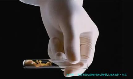 枣庄市妇幼保健院的试管婴儿技术如何？枣庄市妇幼保健院试管婴儿费用明细？