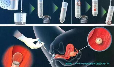 2025年57岁高龄还能做试管婴儿吗？孕前应该怎么做？