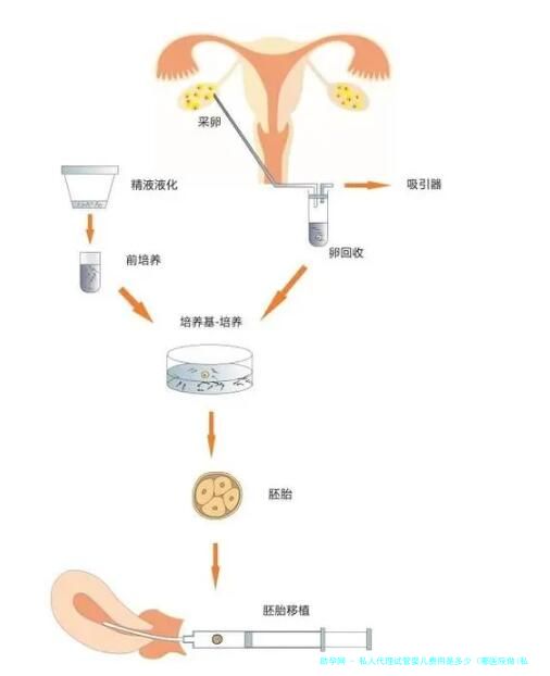 私人代理试管婴儿费用是多少（哪医院做(私人试管婴儿成熟吗)