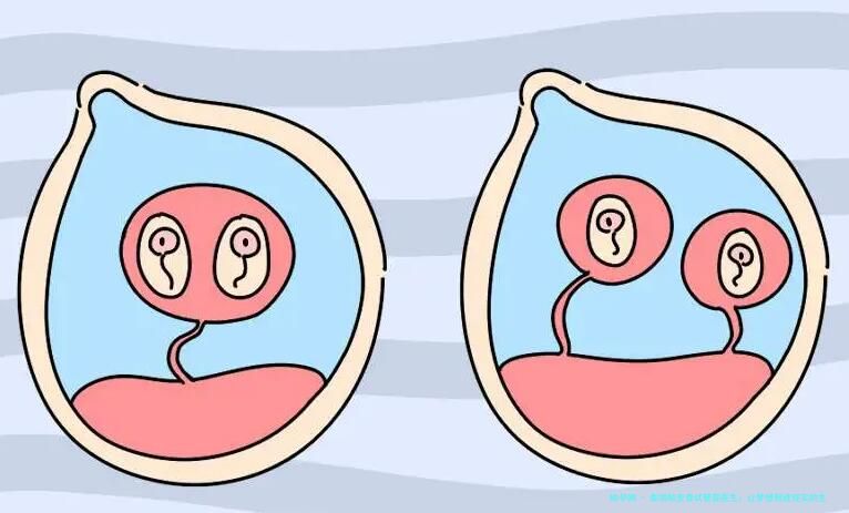 泰国帕亚泰试管婴医生：让梦想照进现实的生育之路