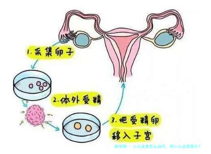 小儿皮疹怎么治疗，附小儿皮疹图片？