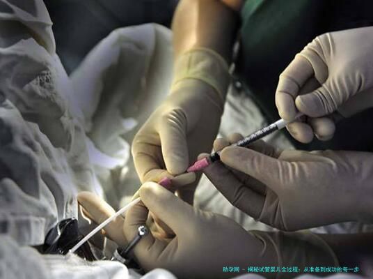 揭秘试管婴儿全过程：从准备到成功的每一步