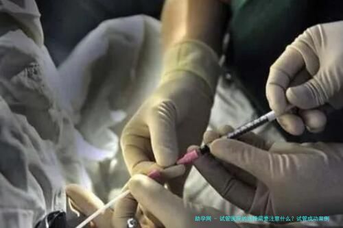 试管医院的选择需要注意什么？试管成功案例分享附详细经历和费用 ...？