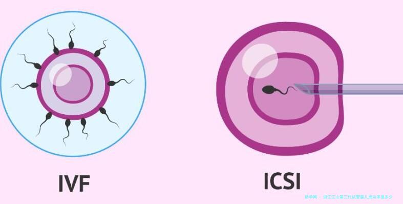 浙江江山第三代试管婴儿成功率是多少