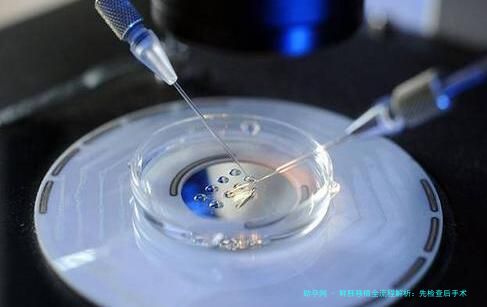 鲜胚移植全流程解析：先检查后手术