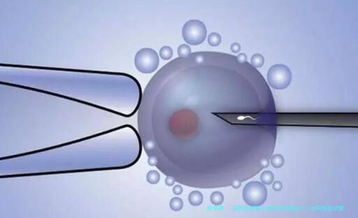 美国试管婴儿的成功率是多少？如何提高试管婴儿的成功率？