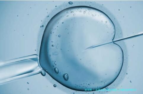 去湖北武汉做试管婴儿步骤促排卵疼吗？