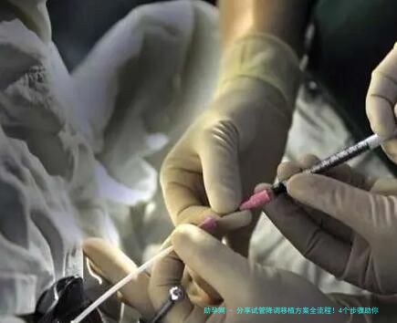 分享试管降调移植方案全流程！4个步骤助你轻松备孕