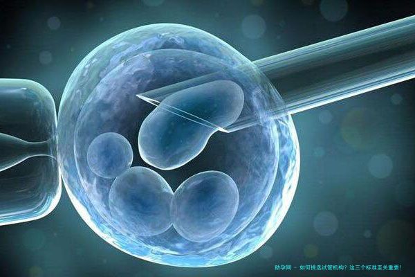 如何挑选试管机构？这三个标准至关重要!