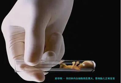 孕妇体内白细胞高危害大，影响胎儿正常发育要重视
