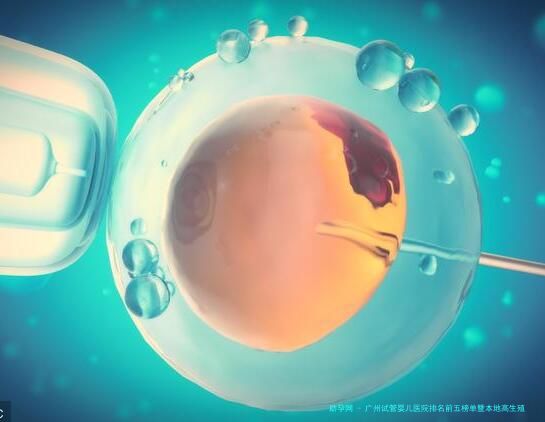 广州试管婴儿医院排名前五榜单暨本地高生殖中心深度评析