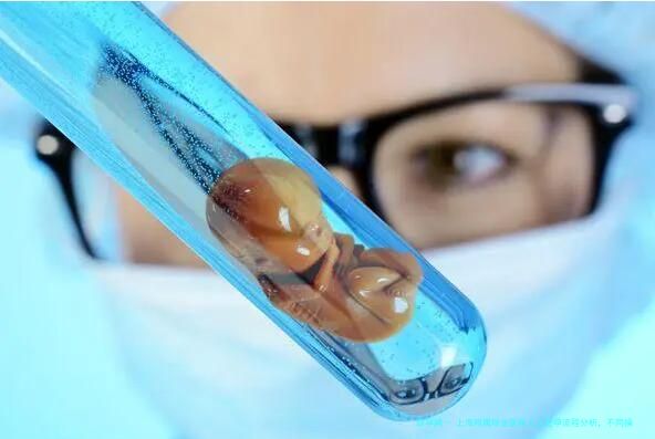 上海附属瑞金医院人工受孕流程分析，不同操作用时差距大