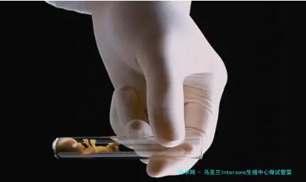 乌克兰Intersono生殖中心做试管婴儿费用是多少？