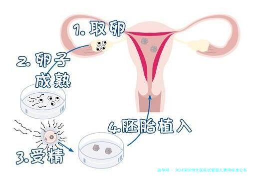 2024深圳恒生医院试管婴儿费用标准公布，单周期不超7万