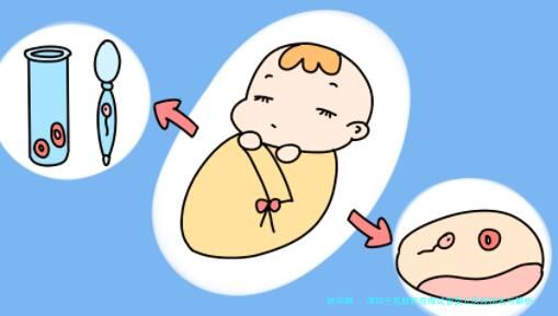 深圳子宫腺肌症做试管婴儿医院排名与解析：附本地妇幼保健院及高机构推荐