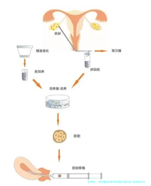 卵泡萎缩会影响试管助孕成功率(这里有应对方法快查收)